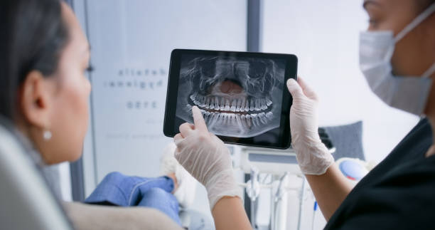 Licensed Tooth Extraction service in Mount Pleasant, IA - Smile Center Dentistry